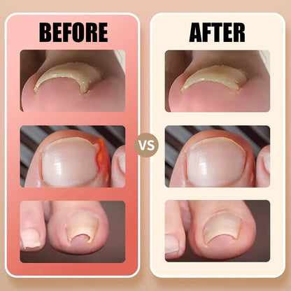 PediCurePro